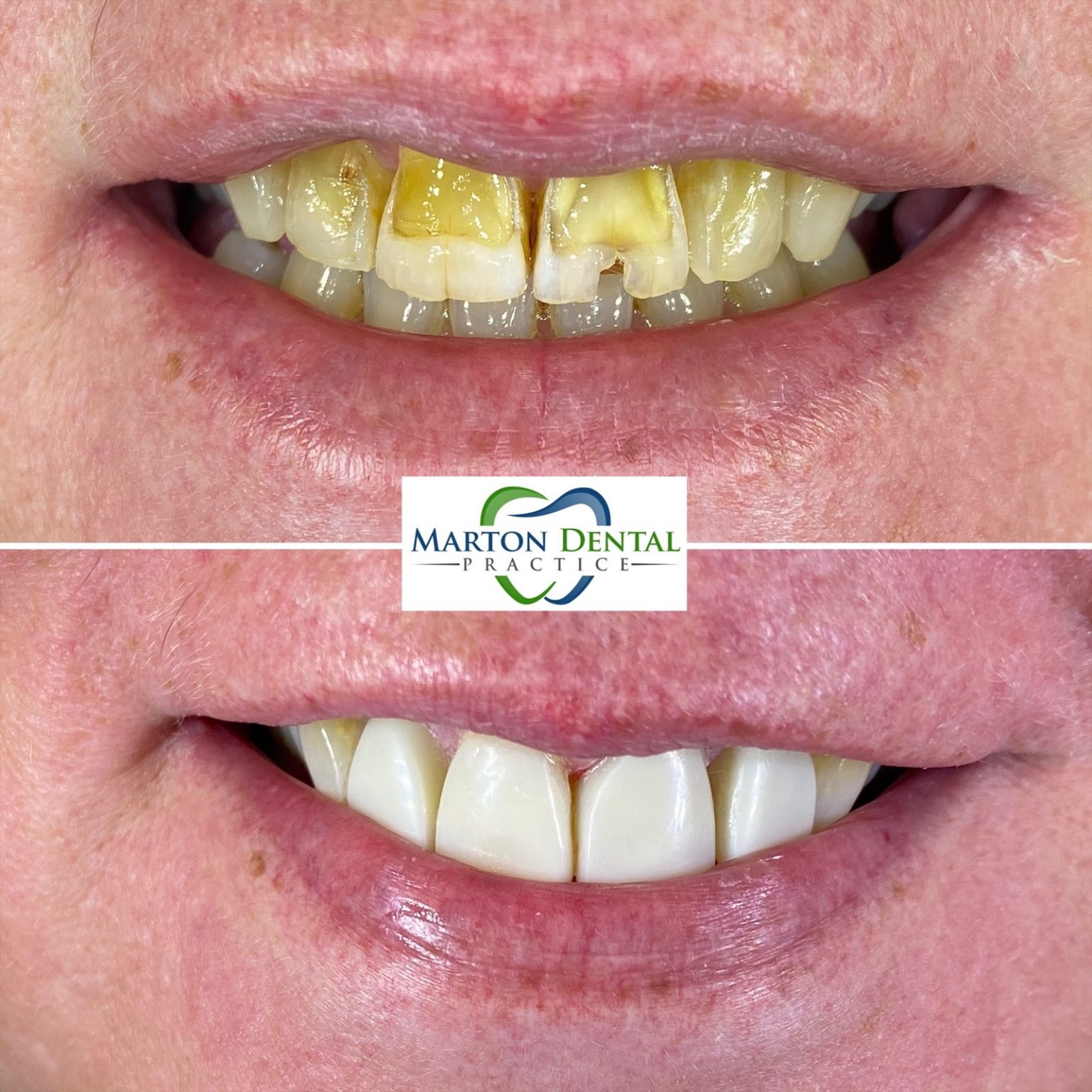 Marton Dental Practice High Quality Family Dental Care In Middlesbrough