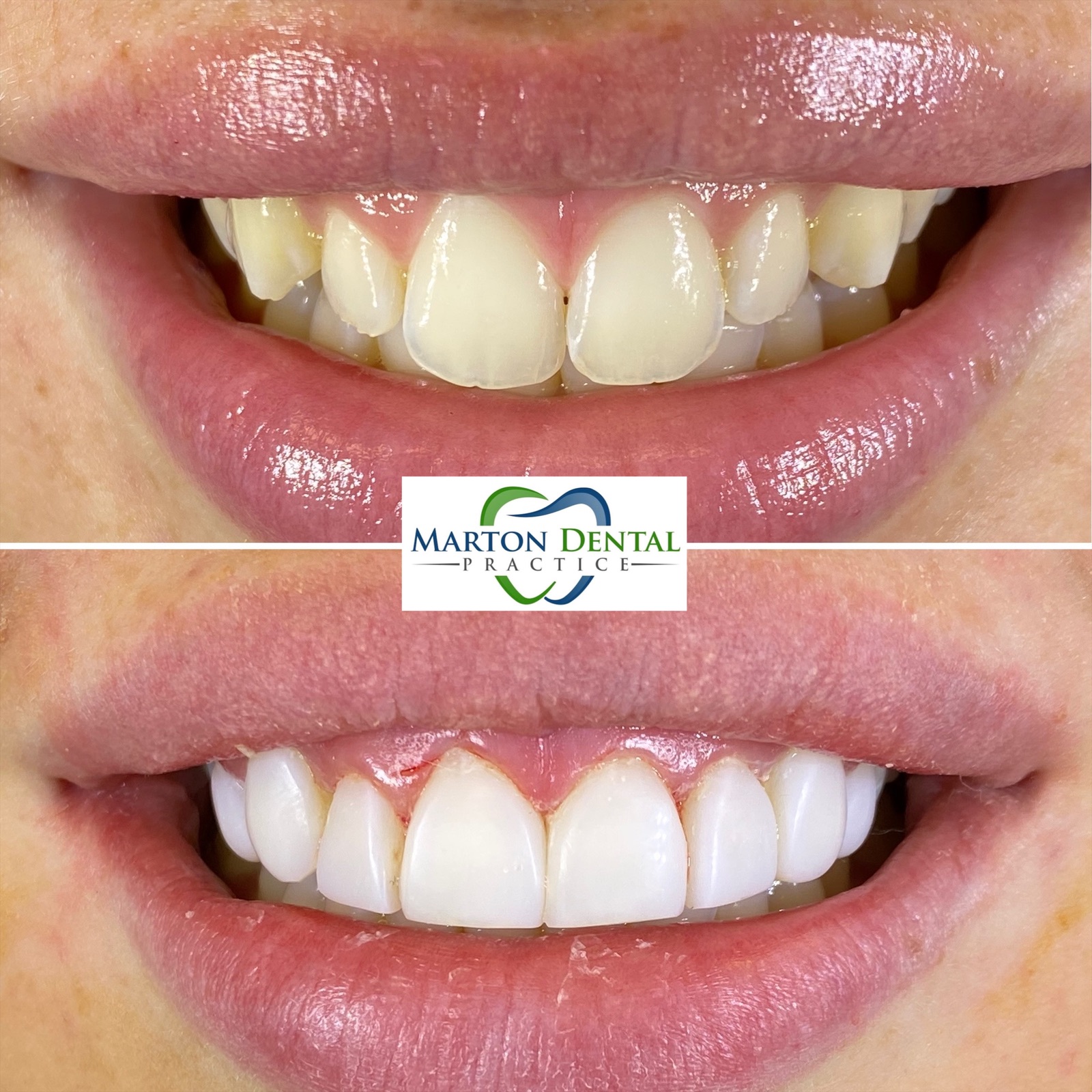 Marton Dental Practice High Quality Family Dental Care In Middlesbrough