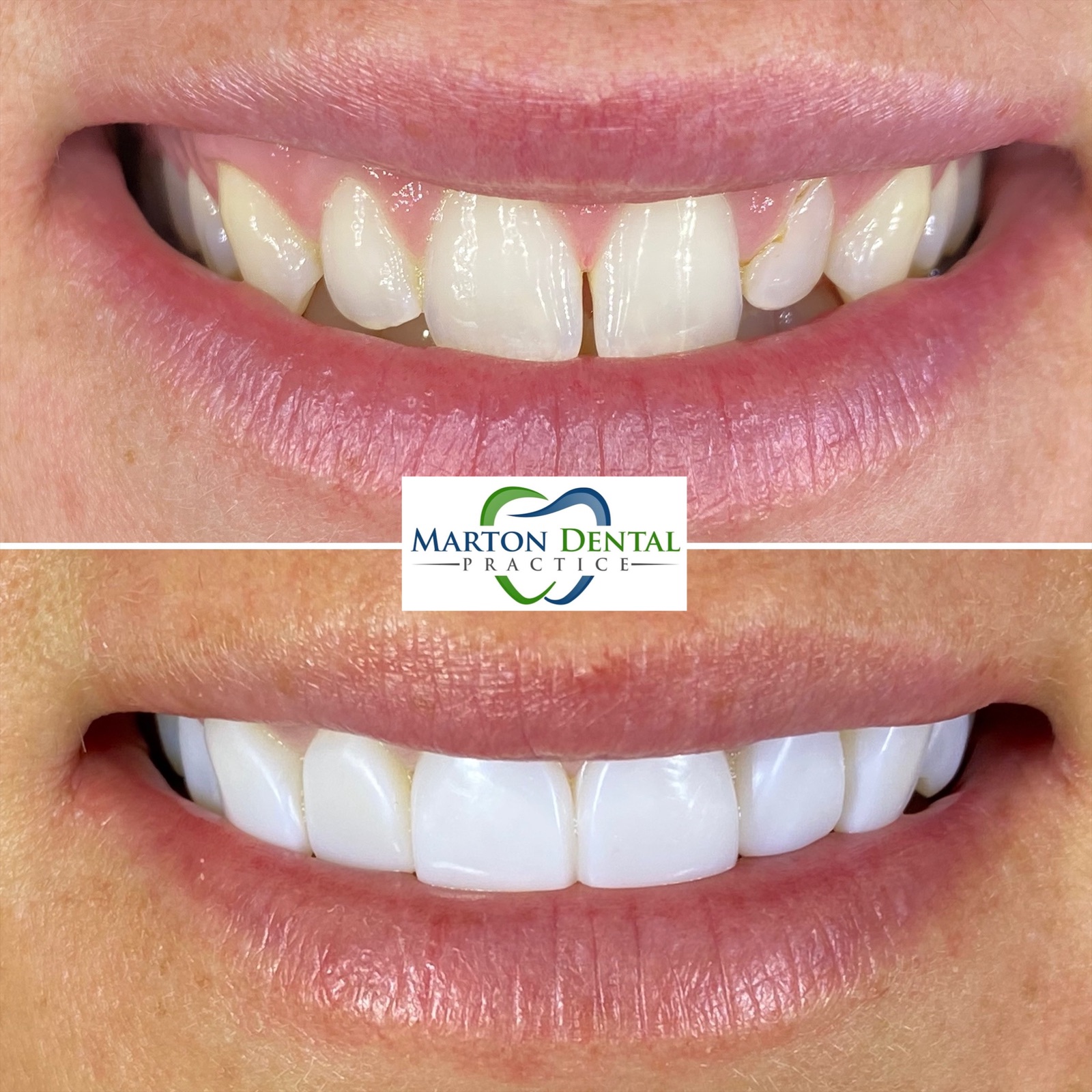 Marton Dental Practice High Quality Family Dental Care In Middlesbrough