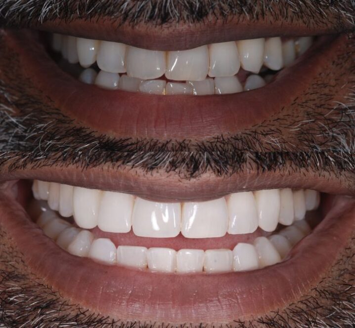 Images by Marton Dental Practice