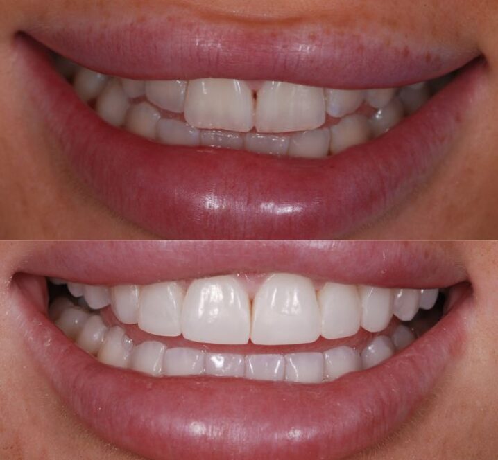 Images by Marton Dental Practice
