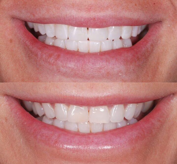 Images by Marton Dental Practice
